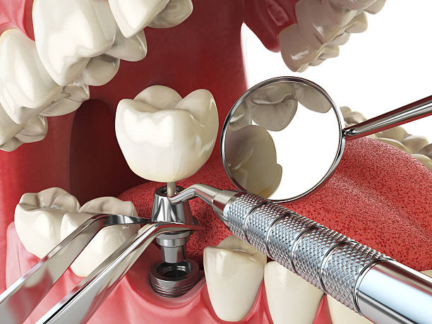 Best Walk-In Emergency Dental Services in Syosset, NY